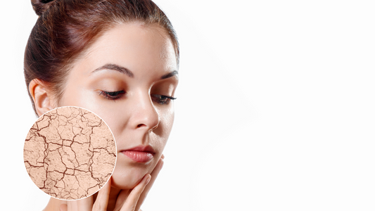 Why is Hard Water Detrimental For Your Skin And Hair ?